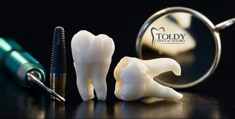 Privatna ordinacija dentalne medicine Dr.Željka Toldy Špoljar