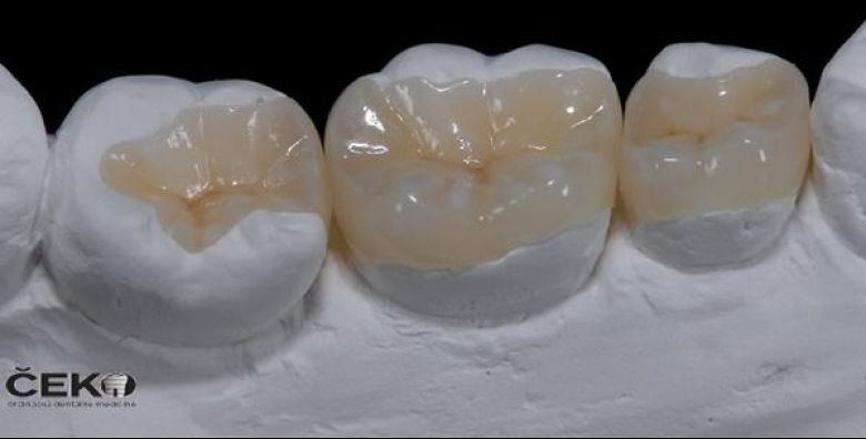 Ordinacija dentalne medicine Milorad Čeko, dr. med. dent.