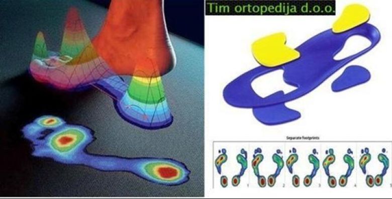Tim ortopedija#Tim ortopedija#Tim ortopedija#Tim ortopedija#Tim ortopedija